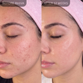 GHK Peptide Serum 2%
